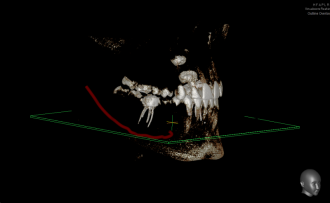 Röntgengerät für die digitale Volumentomographie (DVT) - Mund-, Kiefer- und Gesichtschirurgie, Implantologie & plastische Operationen Dres. Hilscher & Kollegen in 86316 Friedberg