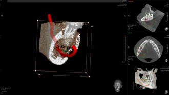 3D-Röntgendiagnostik / DVT - Mund-, Kiefer- und Gesichtschirurgie, Implantologie & plastische Operationen Dres. Hilscher & Kollegen in 86316 Friedberg