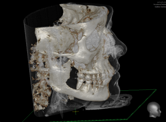 3D-Röntgendiagnostik / DVT - Mund-, Kiefer- und Gesichtschirurgie, Implantologie & plastische Operationen Dres. Hilscher & Kollegen in 86316 Friedberg